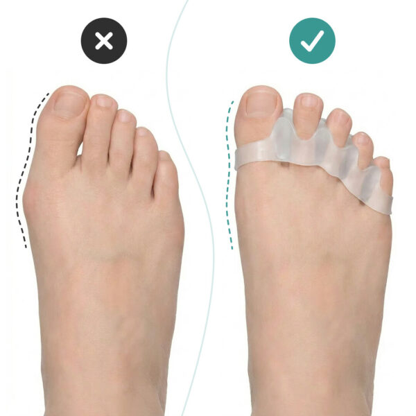 Alternative view of OrthoRelax® – Separator do Palców w Żelu (2 separatory)
