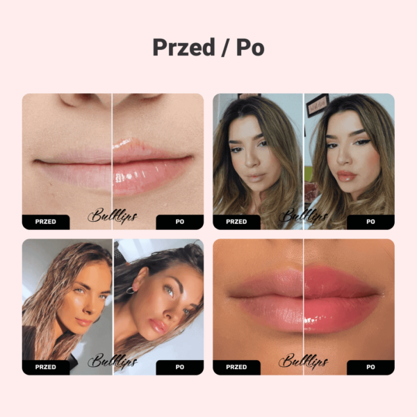 Alternative view of BULKLIPS Zestaw pomadek do ust imbir i mięta